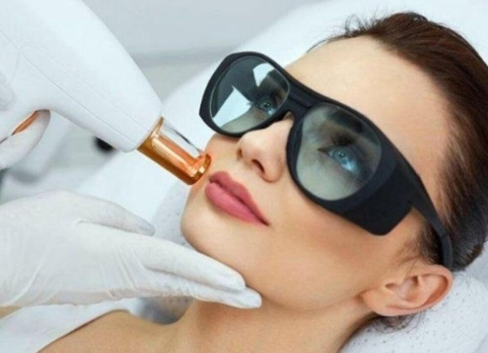 Facial skin rejuvenation